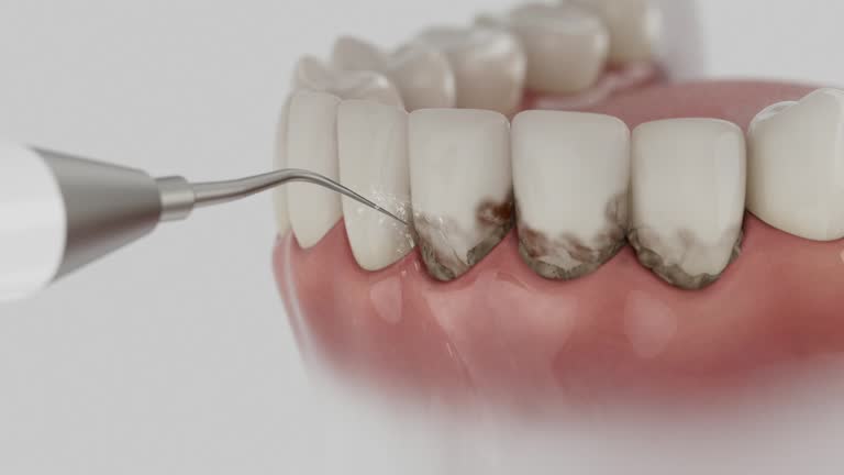 Reliable Dental contractor in Kennesaw State University, GA by Dentist Open Now
